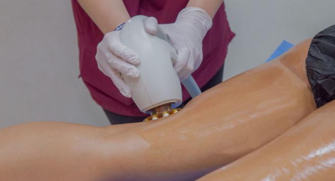 Le dispositif médical non invasif Accent Prime™ est une technique de remodelage corporel à Nice | Clinique des Champs-Elysées