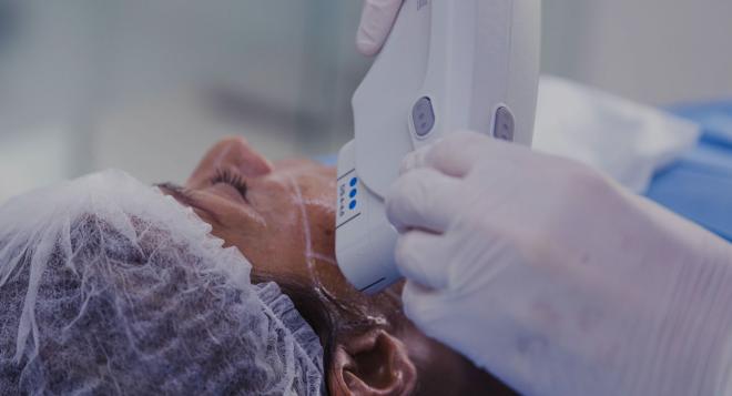 Lifting ultrason sans opération, en médecine esthétique - Ulthera® à Nice | Clinique des Champs-Elysées