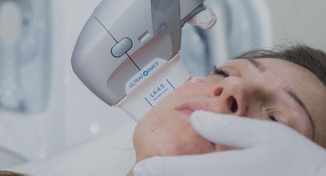 Ultrasons focalisés de dernière génération pour un rajeunissement du visage - Ultraformer® III à Nice | Clinique des Champs-Elysées