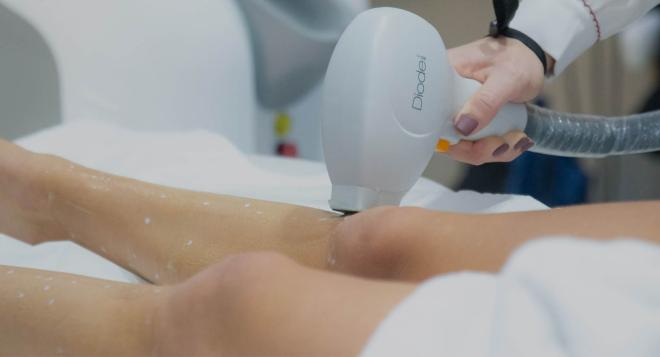 Éliminer définitivement les poils au laser  sur les jambes c’est possible à Nice | Clinique des Champs-Elysées